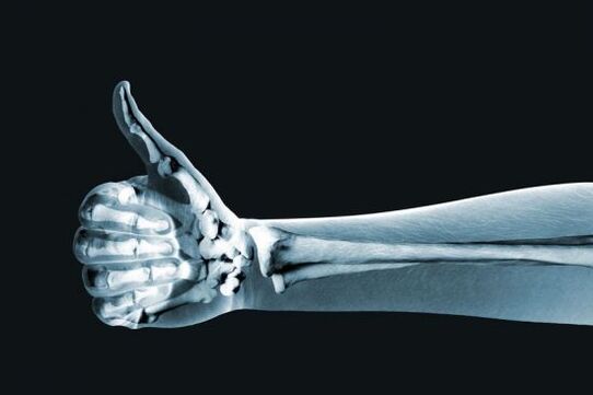 La radiografia può aiutare a diagnosticare il dolore alle articolazioni delle dita
