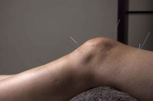 L'agopuntura promuove la riparazione dei tessuti articolari
